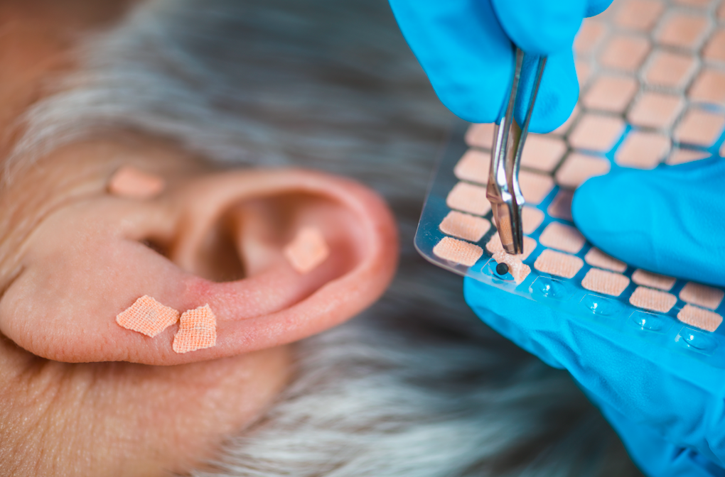 'Pointed ears,' a new trend in plastic surgery, is on the rise